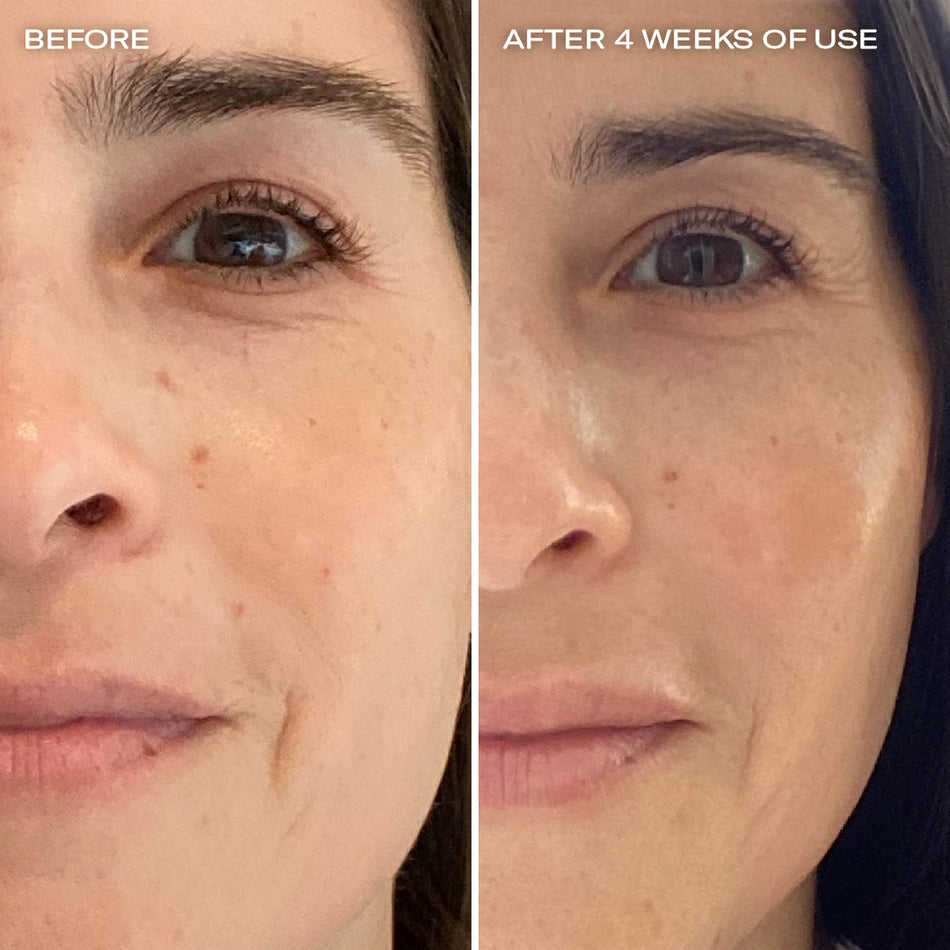 Close-up before and after comparison of a woman's face showing reduced dark spots and smoother skin after 4 weeks of use.