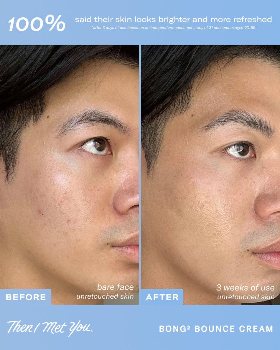 Side-by-side before and after photos of a man's cheek showing clearer skin after using Bong² Bounce™ Cream for 3 weeks.