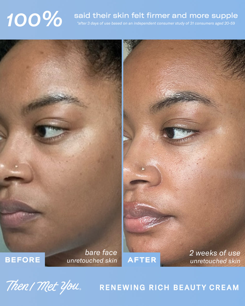 Side-by-side close-up of a woman's bare face showing skin improvement after 2 weeks using Renewing Rich Beauty Cream.