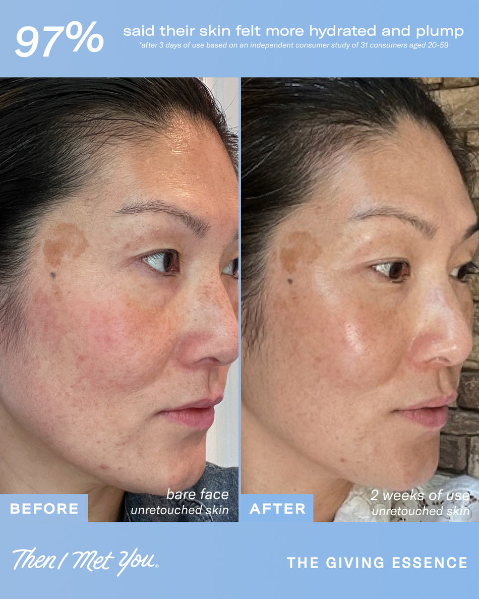 Side-by-side close-up of a woman's face showing skin improvement with reduced redness and smoother texture after using The.