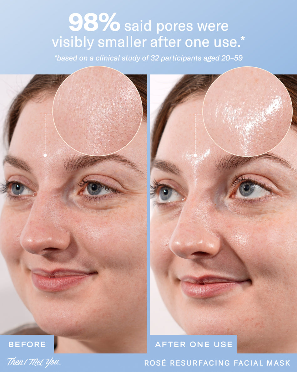 Rosé Resurfacing Facial Mask