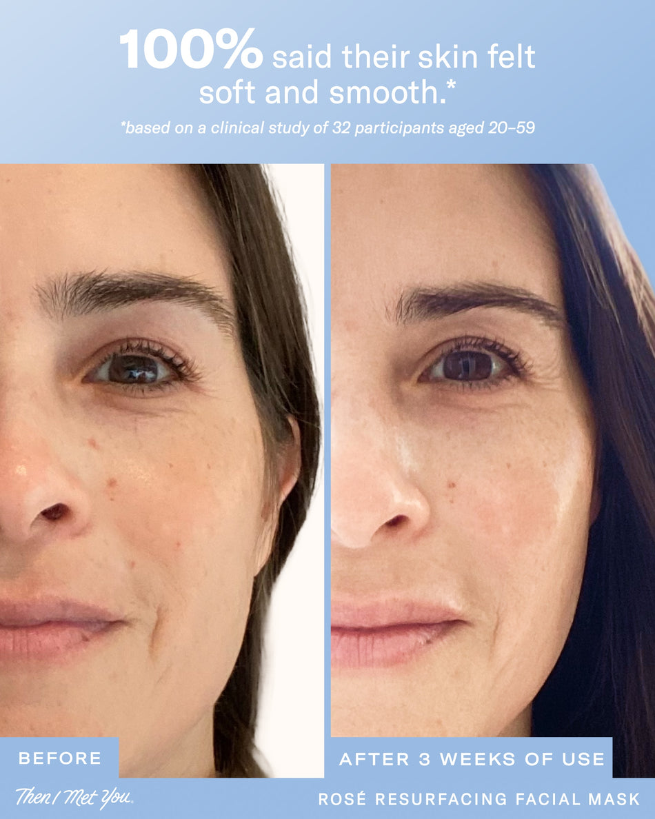 Rosé Resurfacing Facial Mask