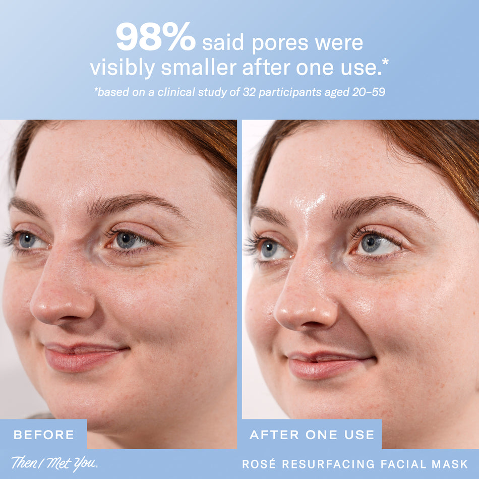 Rosé Resurfacing Facial Mask