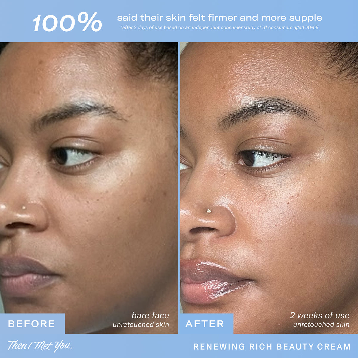 Renewing Rich Beauty Cream