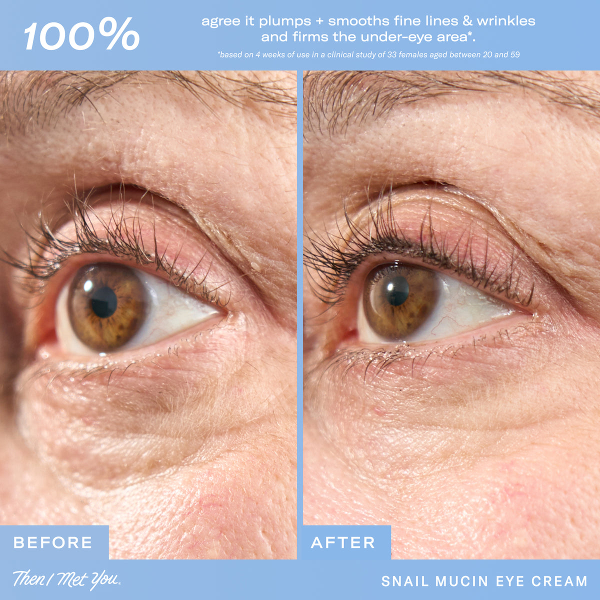 Snail Mucin Eye Cream