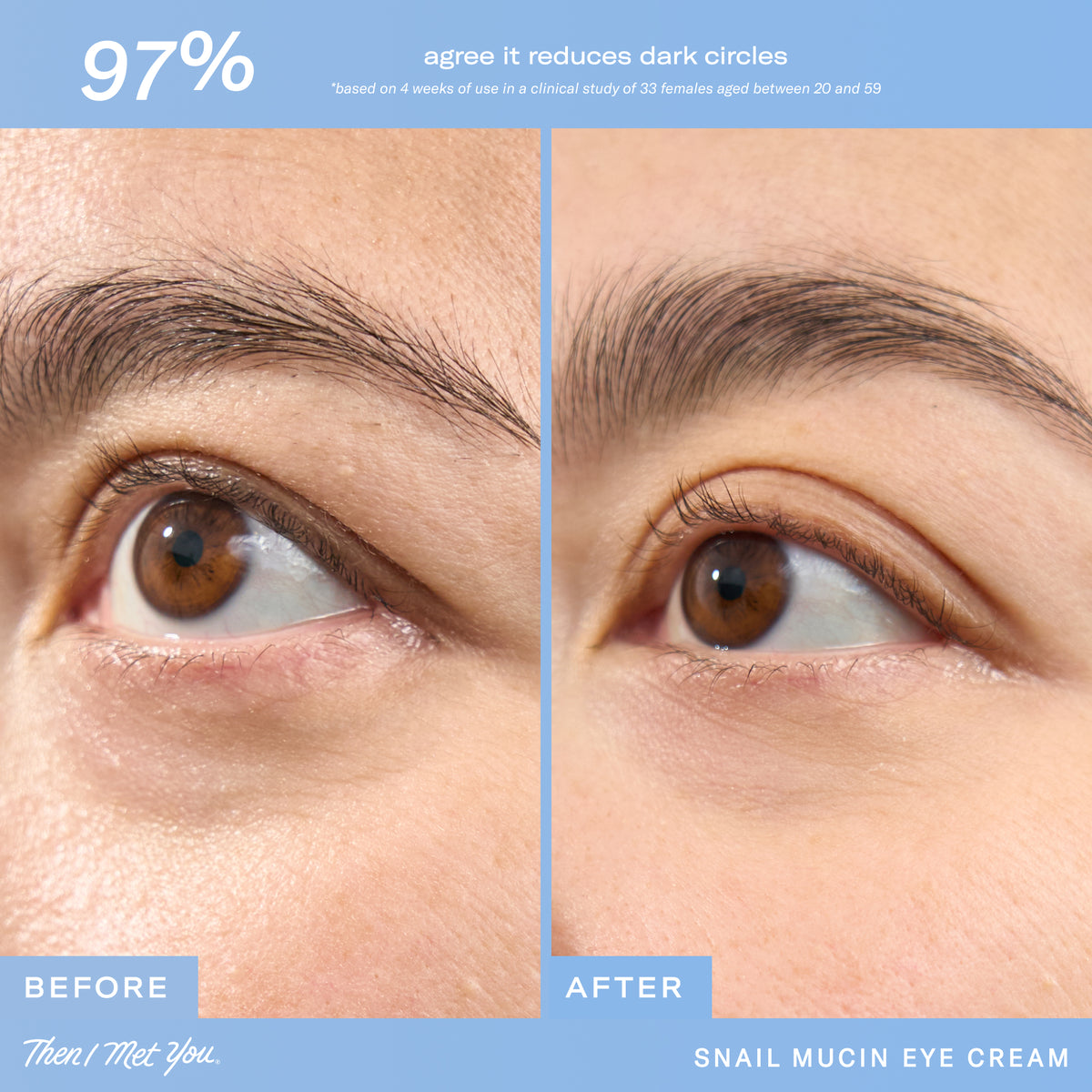 Snail Mucin Eye Cream