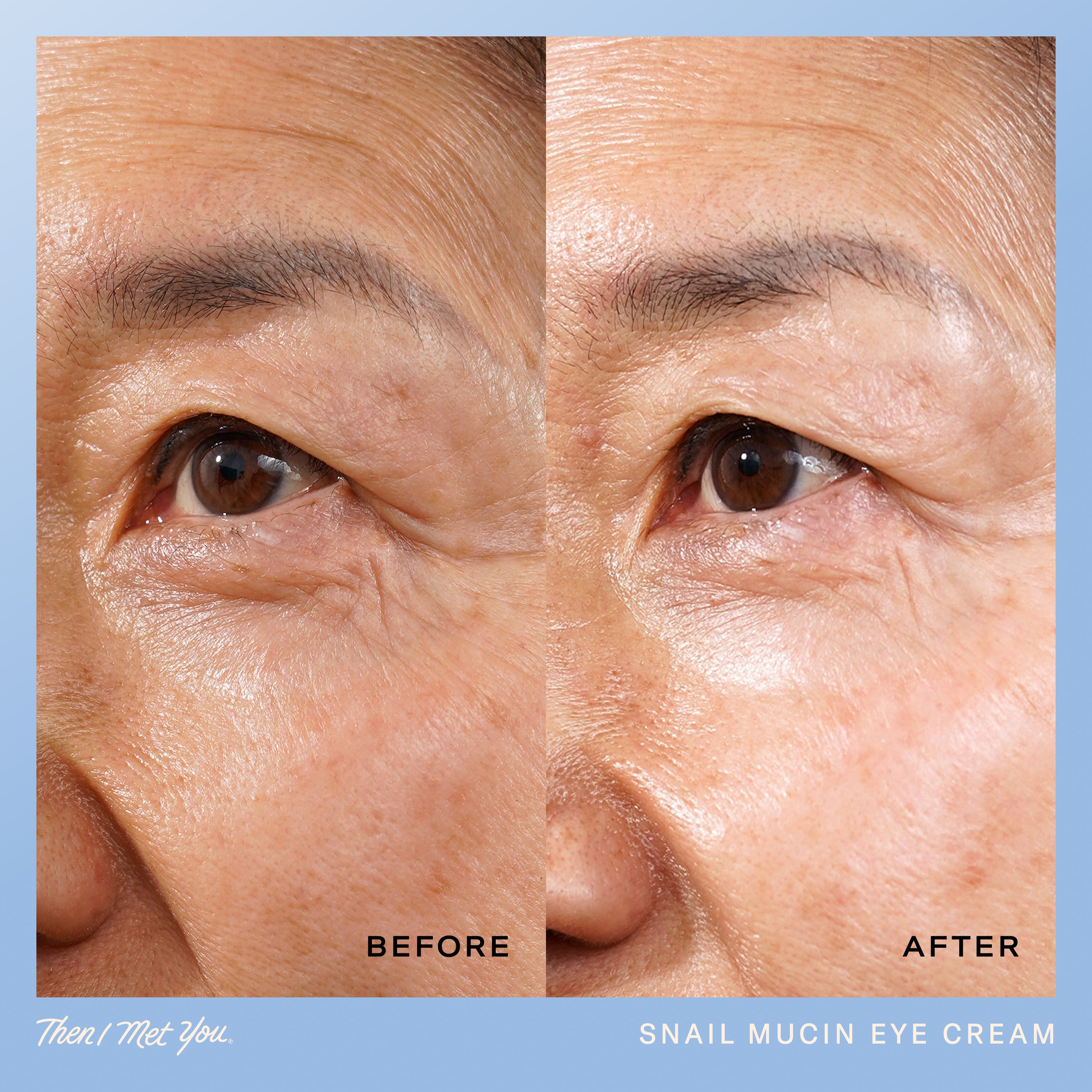 Snail Mucin Eye Cream – Then I Met You